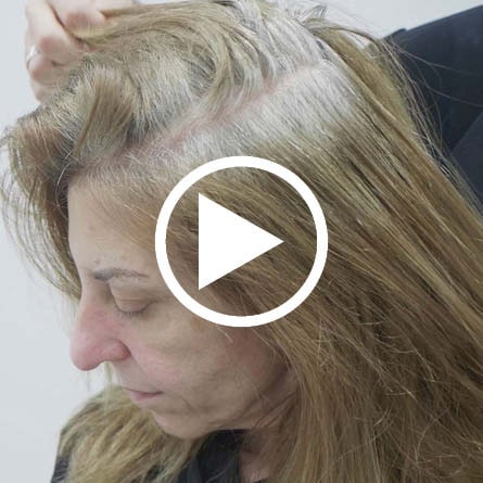 How to - Gray Coverage-image